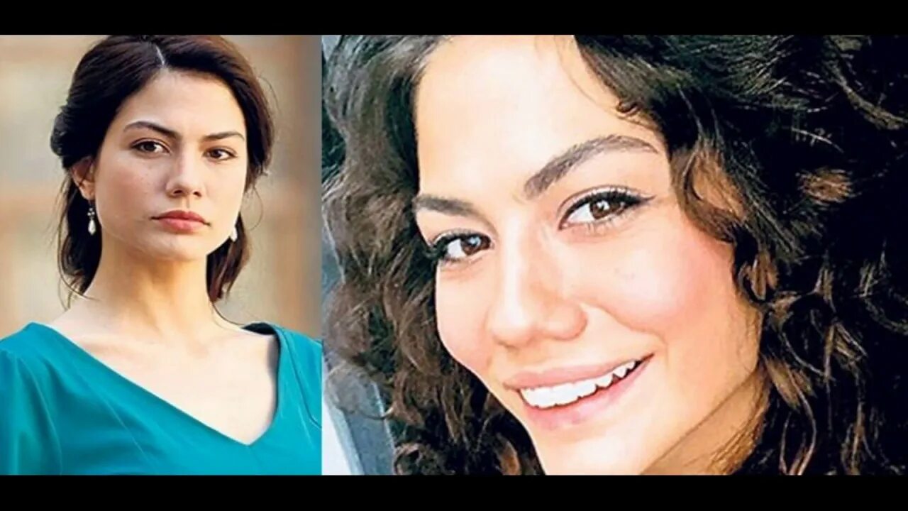 Демет оздемир до. Демет оздемир. Демет оздемир пластика. Демет оздемир пластика. Демет до и после пластики.