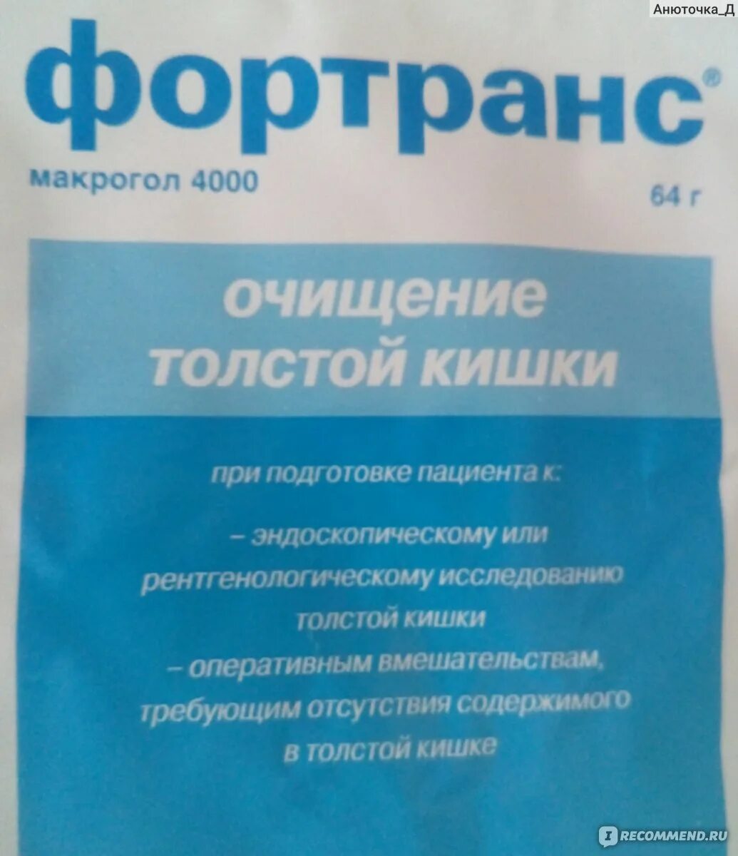 Стул после фортранса