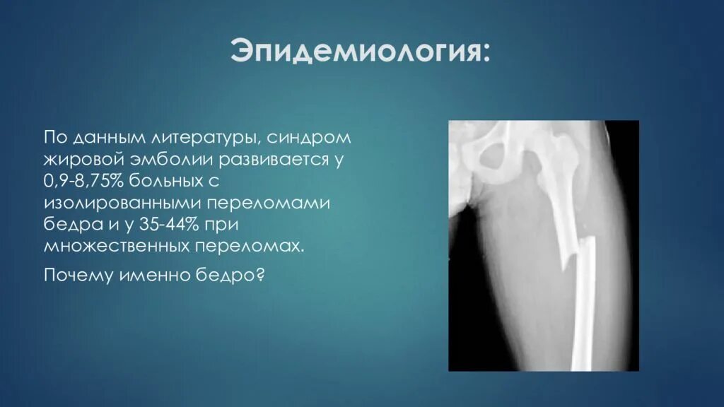 Шок при множественных переломах. Синдром жировой эмболии. Эпидемиологические синдром. Профилактика жировой эмболии.