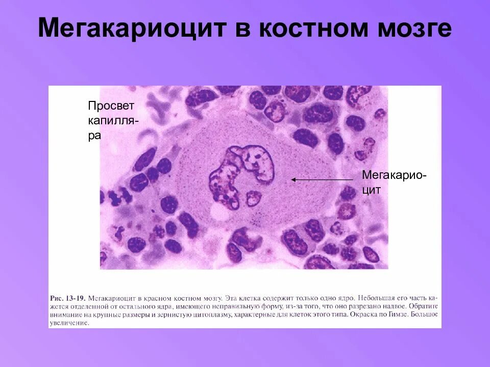 Тромбастения гланцмана. Мегакариоциты красного мозга. Мегакариоциты красного мозга. Мегакариоциты в костном мозге гистология. Мегакариоцит гистология.