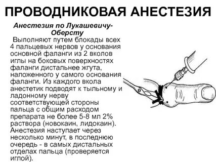 Обезболивающие пальца