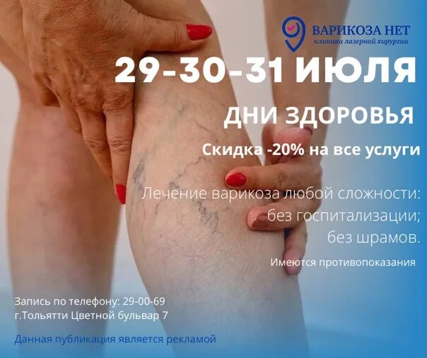 Варикоза нет улан. Варикоза нет тольятти. варикоза нет тольятти на цветном бульваре.