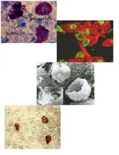 Chlamydia trachomatis neisseria gonorrhoeae. Хламидия трахоматис микроморфология. Хламидия трахоматис (HSP-60. Язвы, вызванные хламидией трахоматис. Хламидии трахоматис у мужчин.