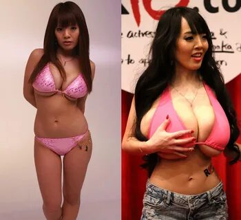 Hitomi tanaka breast reduction