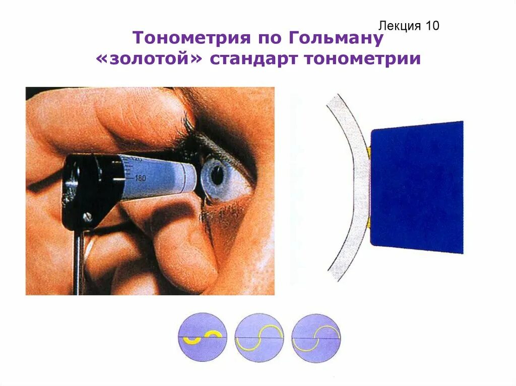 Тонометрия что это. Тонометрия что это