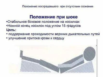 Оптимальное положение при отсутствии сознания