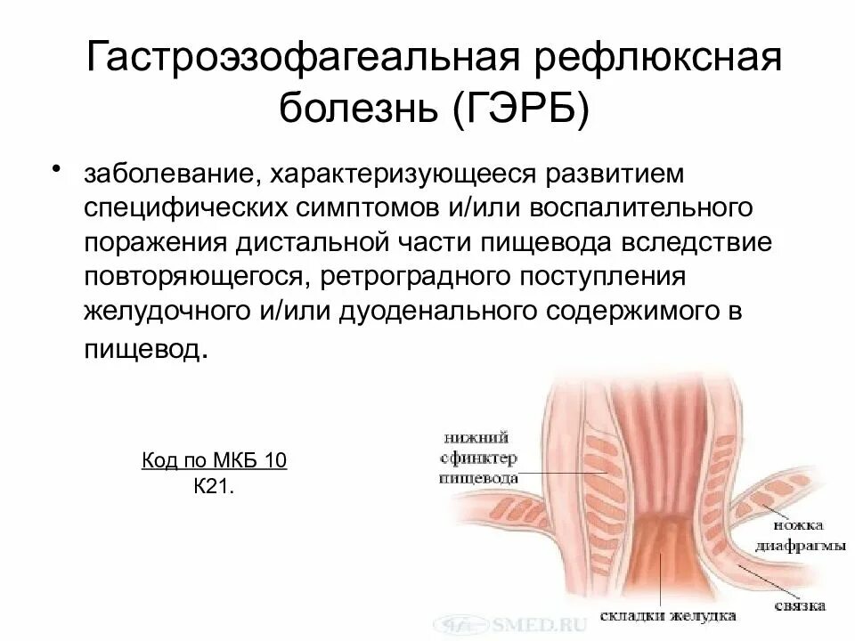 Гастроэзофагеальная рефлюксная болезнь. Гастроэзофагеальный рефлюкс код по мкб 10. Гастроэзофагеальный рефлюкс мкб 10. Рефлюксный эзофагит мкб.