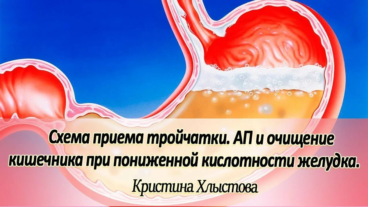 Гипоацидный гастрит. Хронический гипоацидный гастрит. Гипоацидное состояние желудка. Повышенная кислотность желудка. Анацидный гастрит это