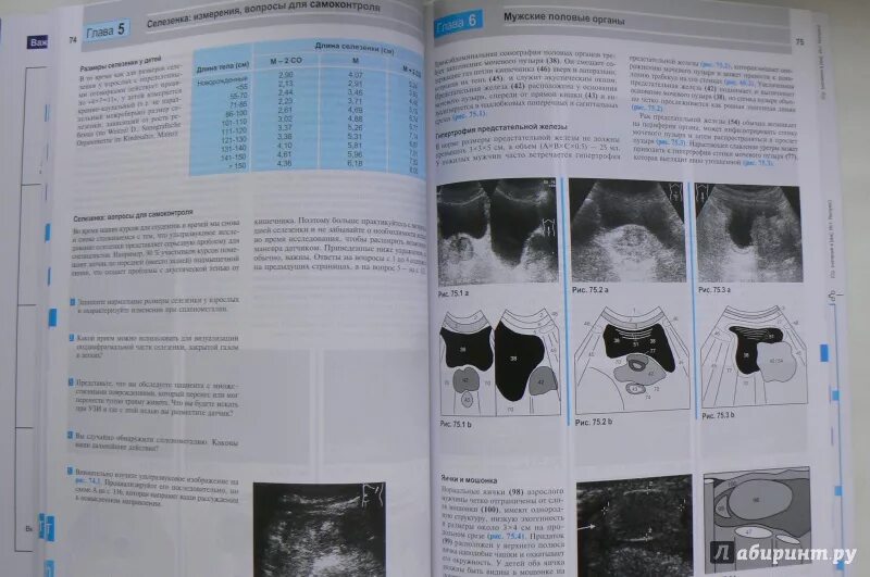 Матиас Хофер ультразвуковая диагностика. Атлас по УЗИ диагностике. Ультразвуковая диагностика книги