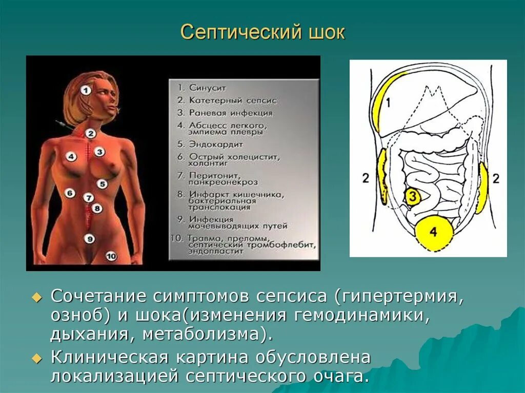 Заражение крови как выглядит человек ВИЧ-инфекция грозное заболевание БУ "Республиканский клинический госпиталь д