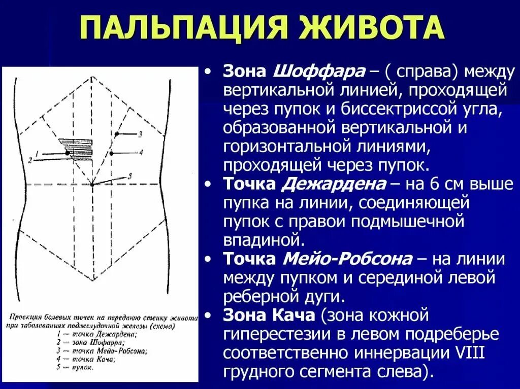 Симптомы кача Мейо-Робсона Дежардена. Зона Шоффара пальпация. Точка Дежардена и зона Шоффара точка Мейо-Робсона. Точка Кера Мейо Робсона. Область живота в напряжении