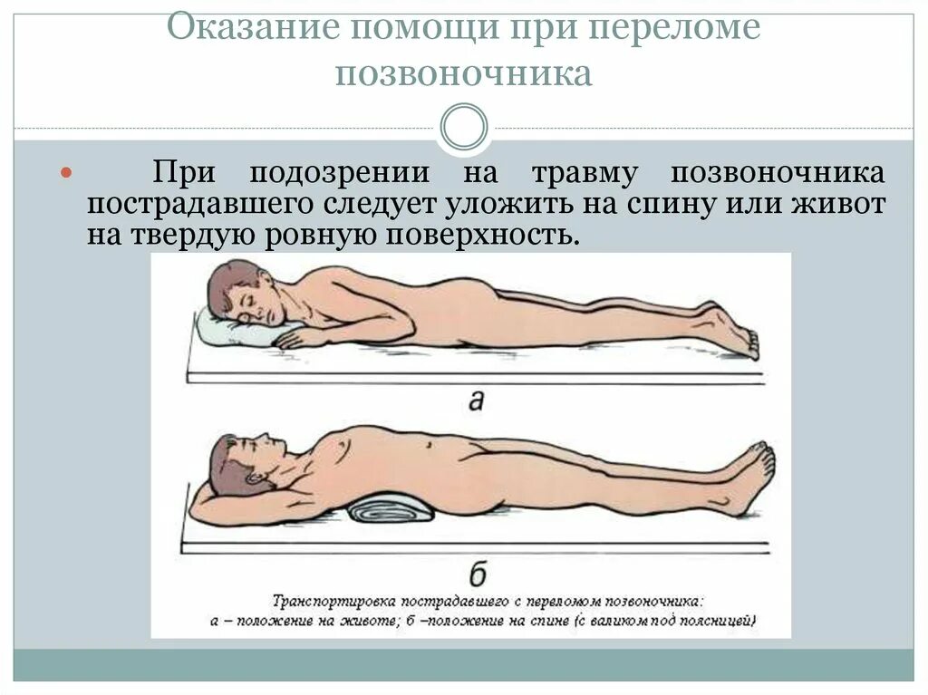 Первая помощь при подозрении на перелом позвоночника. Оказание первой помощи при переломе спины. Оказание первой помощи при сломанном позвоночнике. Порядок оказания первой помощи при переломе позвоночника.