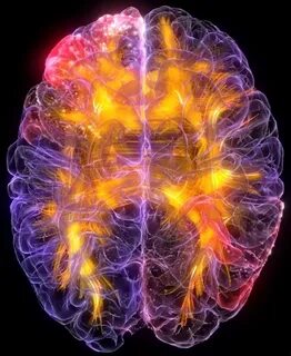 Fusion brain