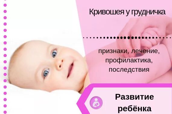 Врожденной мышечной кривошее. Профилактика кривошеи. Профилактика кривошеи. Профилактика кривошеи. Правосторонняя кривошея.