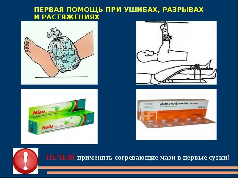 Оказание первой помощи при ушибах. Мазь при ушибах и растяжениях травмах. Оказание первой помощи при вывихах и ушибах.