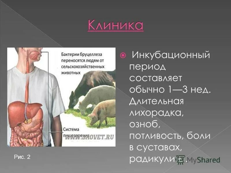 Бруцеллез клинические проявления. Бруцеллез симптомы кратко у человека. Бруцеллез презентация инфекционные болезни. Что за болезнь бруцеллез у человека симптомы