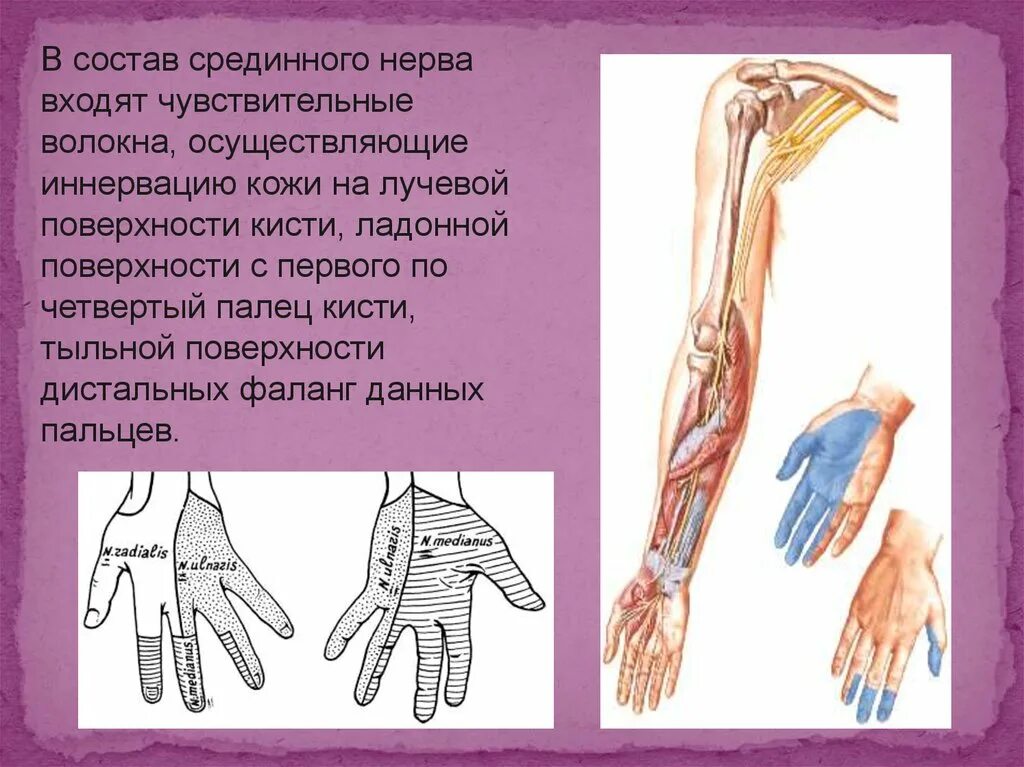 Нейропатия кисти. Зона иннервации срединного нерва. Неврит срединного нерва реабилитация. Иннервация срединного нерва кисти. Невропатия срединного нерва.