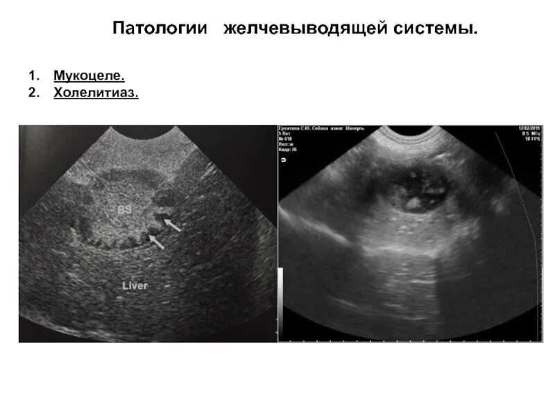 Мукоцеле желчного пузыря у собак. Мукоцеле желчного пузыря УЗИ. Мукоцеле желчного у собаки УЗИ.