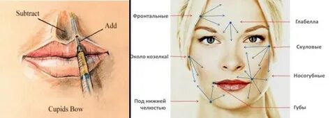 Точка колоть