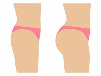 Butt Implants to a More Gorgeous Behind - Plastic Surgeon| Cosmetic Surgeon by Wi...