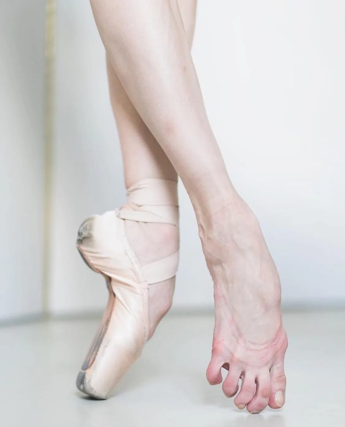 как выглядят ноги балерины