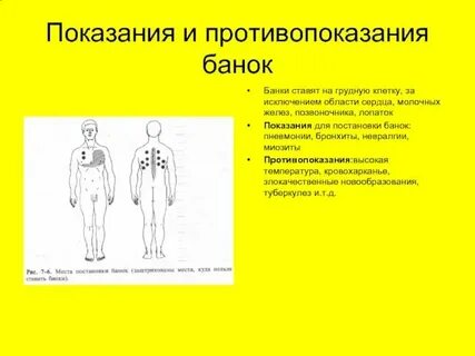 Сколько времени держать банки как ставить