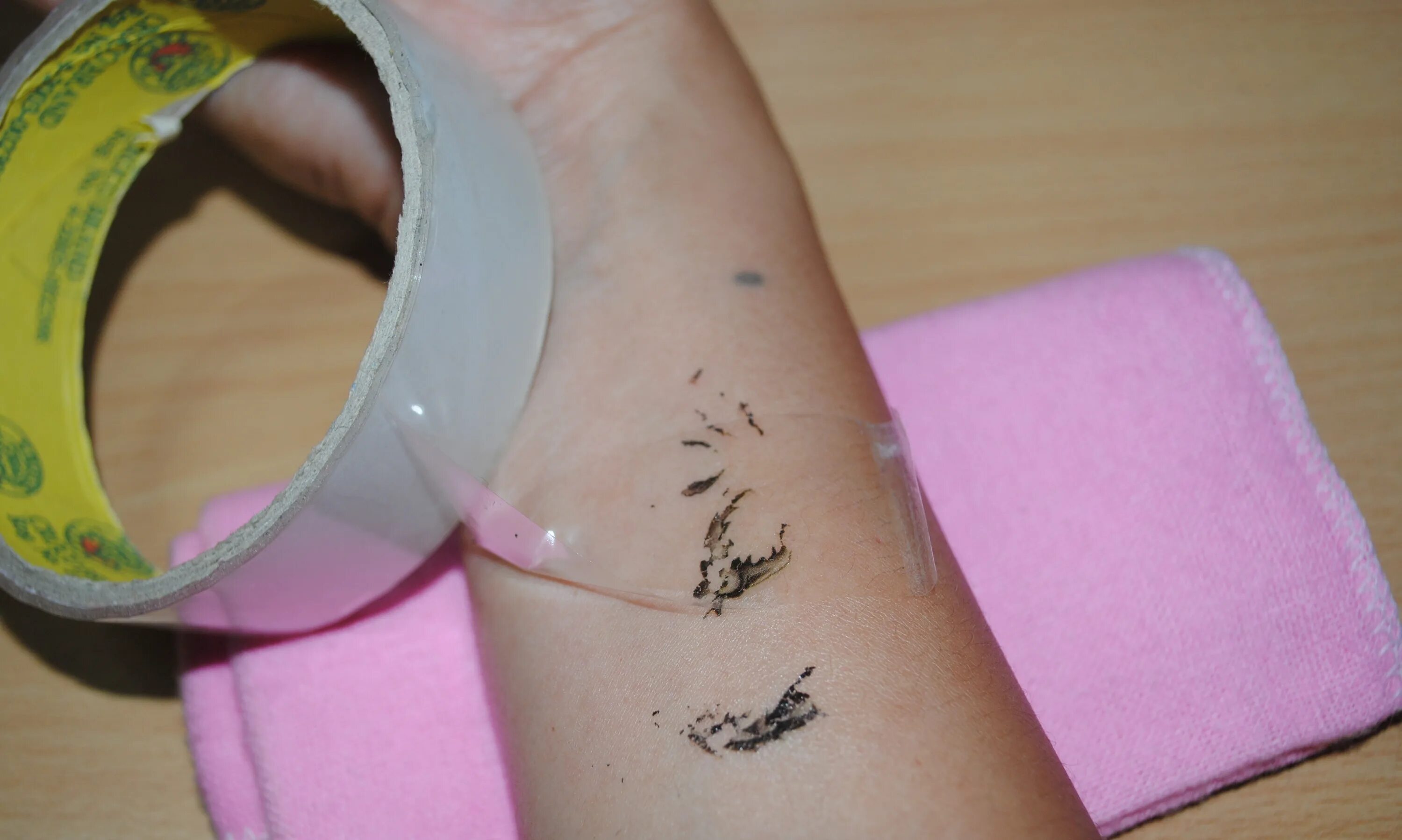 Как удалить домашнюю тату. Выведение татуировки до и после. Как удалить домашнюю тату. Избавление от татуировок. Выведение татуировки в домашних условиях.