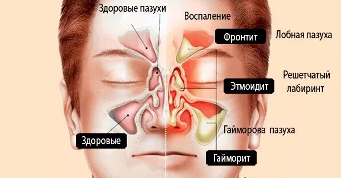 Синусин