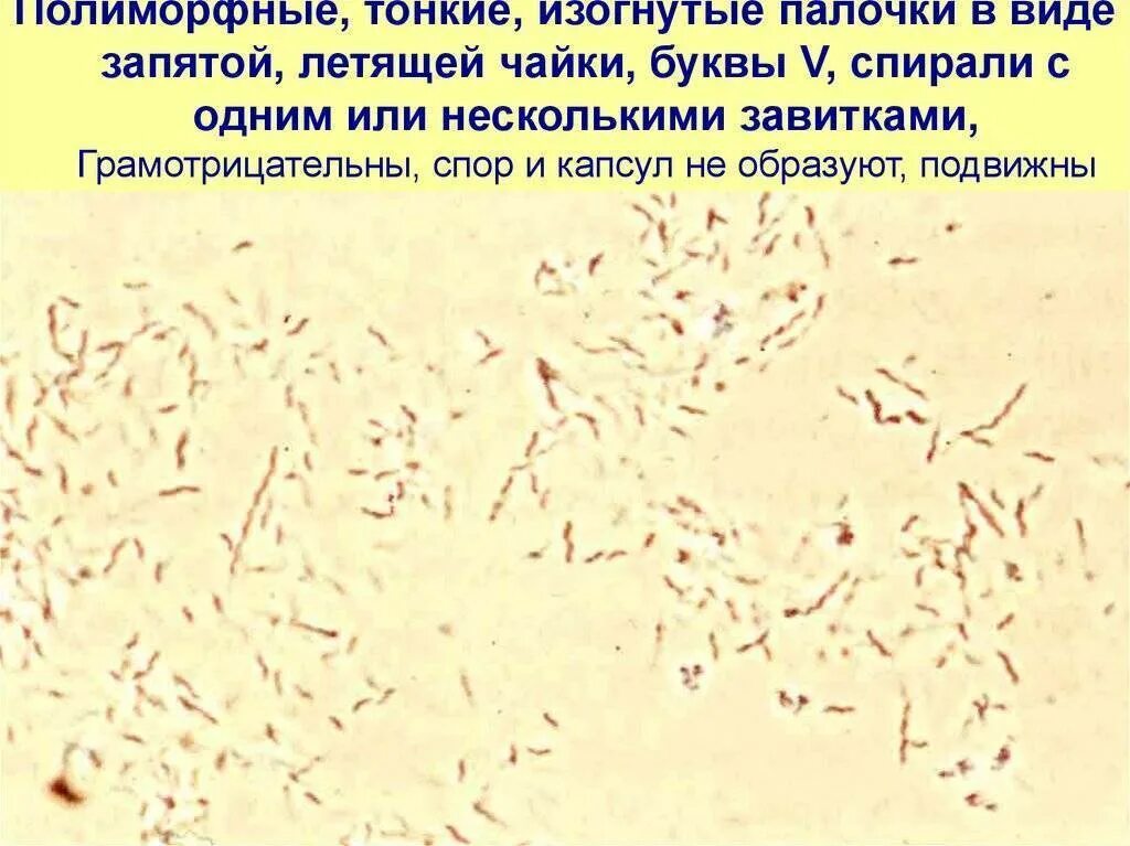 Крупные грамположительные палочки. Полиморфные палочки что это такое. Грамположительные изогнутые палочки. Полиморфные палочки что это такое. Полиморфные палочки что это такое.