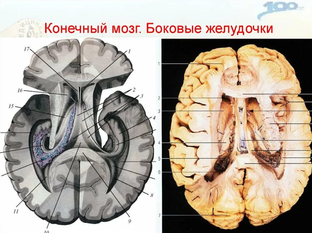 Боковые желудочки головного мозга анатомия. Желудочки головного мозга на препарате. Структура головного мозга, желудочки. Конечный мозг анатомия желудочки мозга. Правый желудочек головного