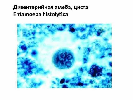 Амеба дизентерийная среда
