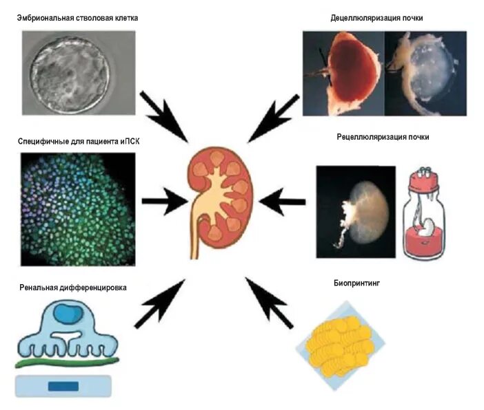 Стромальные клетки почки. Стволовые клетки почки. Эмбриональная стволовая клетка.