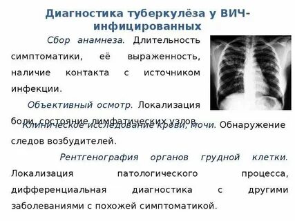 Туберкулез пример