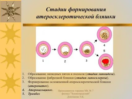Формирование бляшки
