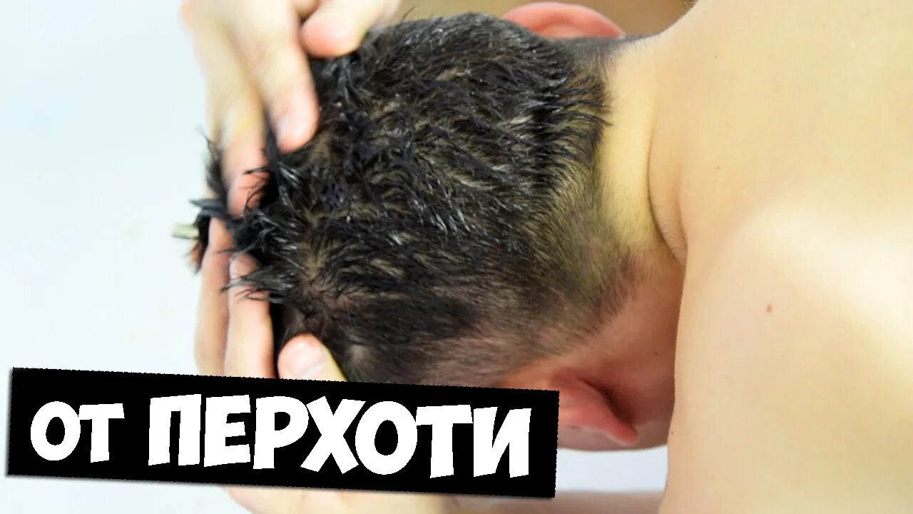 Как избавиться от перхоти навсегда. Методы избавления от перхоти. процедура от избавления перхоти.