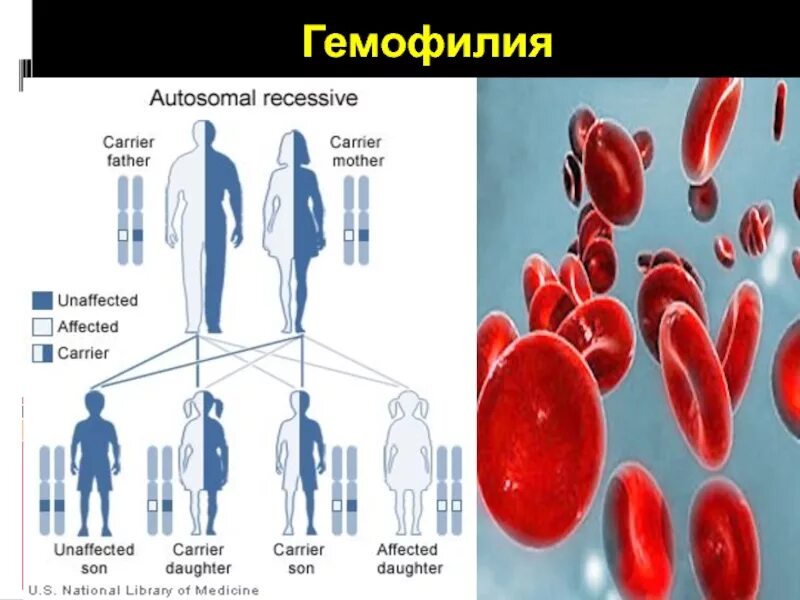 Гемофилия как определить