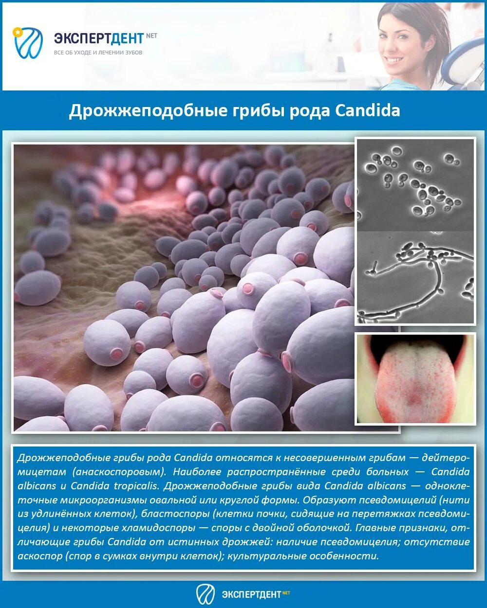 Candida чем лечить. Дрожжеподобный грибок кандида. Дрожжеподобный гриб рода Candida. Дрожжеподобные грибы типа кандида..