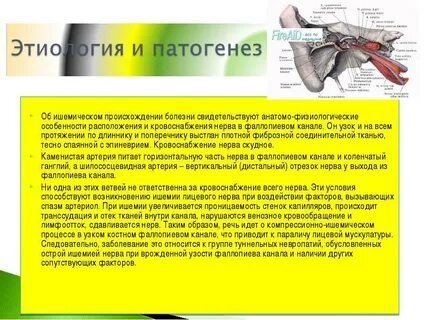 Нейропатия лицевого нерва