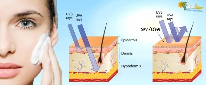 UVA UVB лучи что это. Лучи ультрафиолетовые UVA UVB. Воздействие УФ излучения на кожу. Защита кожи от ультрафиолетовых лучей. Спф при каком уф