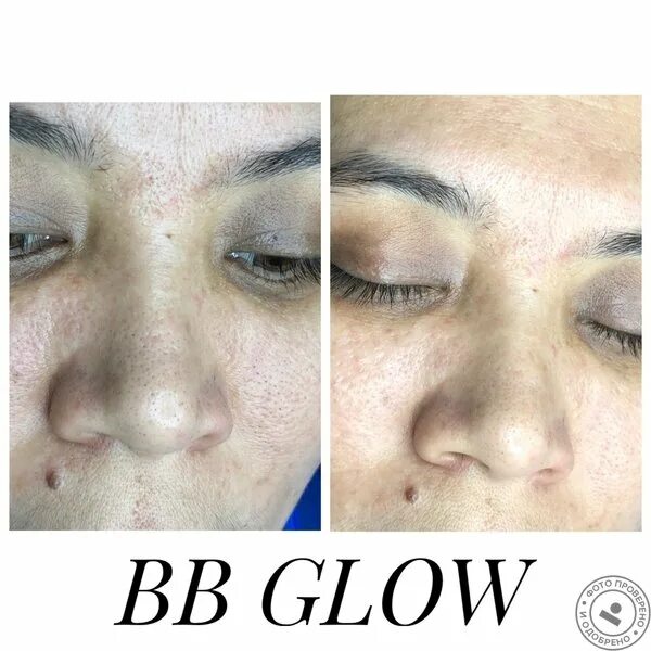 Bb glow для лица. Bb glow( эффект тонального крема на год). Bb glow для лица. Эффект тонального крема bb glow. Эффект бб глоу.