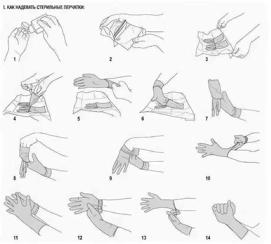 Схема одевания стерильных перчаток. Надевание и снятие стерильных перчаток алгоритм. Одевание стерильных перчаток алгоритм. Снятие стерильных перчаток алгоритм. Алгоритм стерильных перчаток