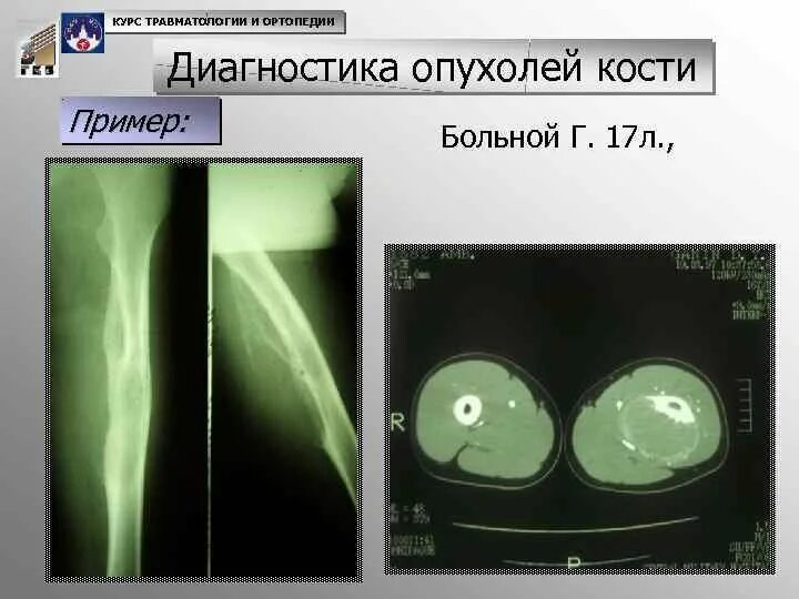 Диагноз 85