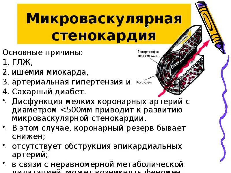 Другие стенокардии мкб. Другие стенокардии мкб