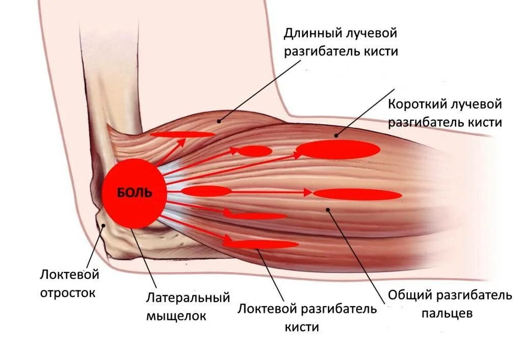 Болят локти после