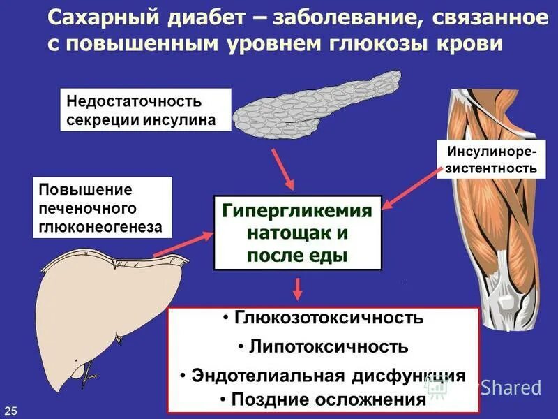 Развитие сахарного диабета связано с