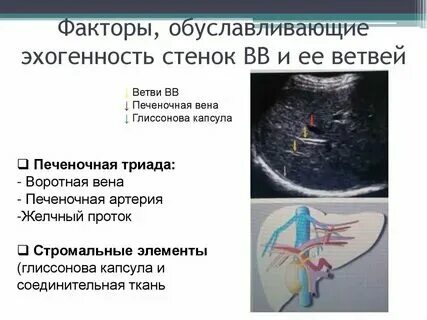 Структура поджелудочной диффузно неоднородная эхогенность повышена