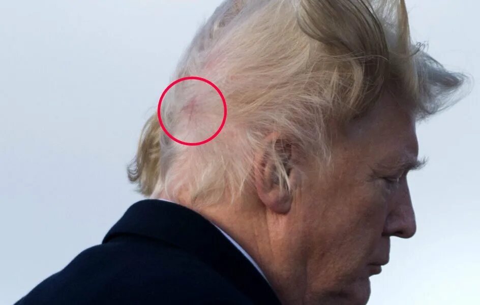 Trump Believes His Hair Gives Him 'Wealth & Power' - YouTube