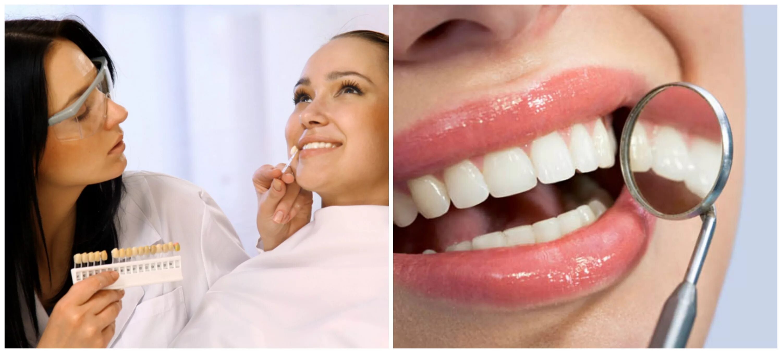 Отбеливание зубов год. Отбеливание зубов. Отбеливание зубов в стоматологии до и после. Методы отбеливания зубов в стоматологии. Отбеливание витальных зубов.