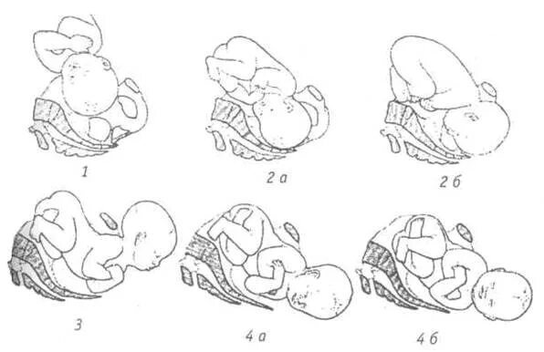 Б п родов. Передний вид затылочного предлежания биомеханизм родов. Задний вид затылочного предлежания биомеханизм. Механизм родов при переднем виде затылочного предлежания. Задний вид головного предлежания биомеханизм родов.