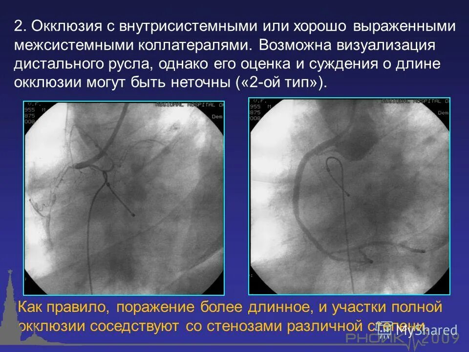 Автоматия гладких мышц. Вывод о занятии. Психологический портрет маньяка. Матусовский есть слова пострашнее. Неправильная форма сосков.